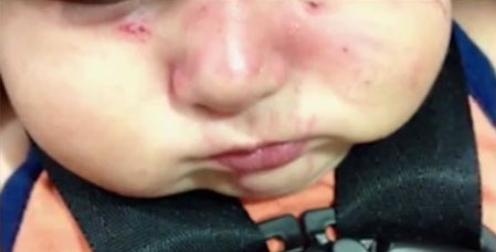 State Investigates San Antonio Daycare After Baby Bitten 27 Times State Investigates San Antonio Daycare After Baby Bitten 27 Times